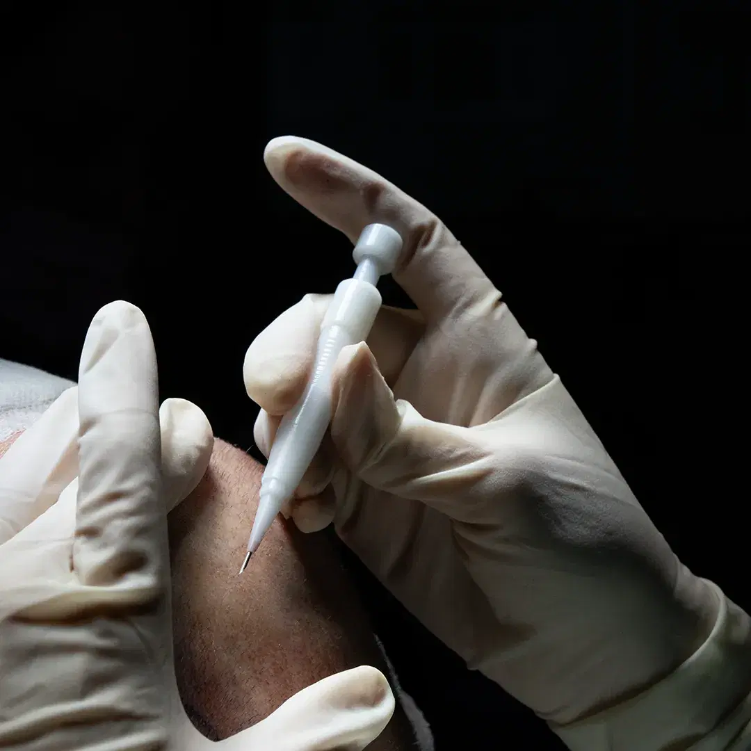 <h3><span style="color: rgb(247, 248, 248);"><strong>Direct implantation</strong></span></h3>