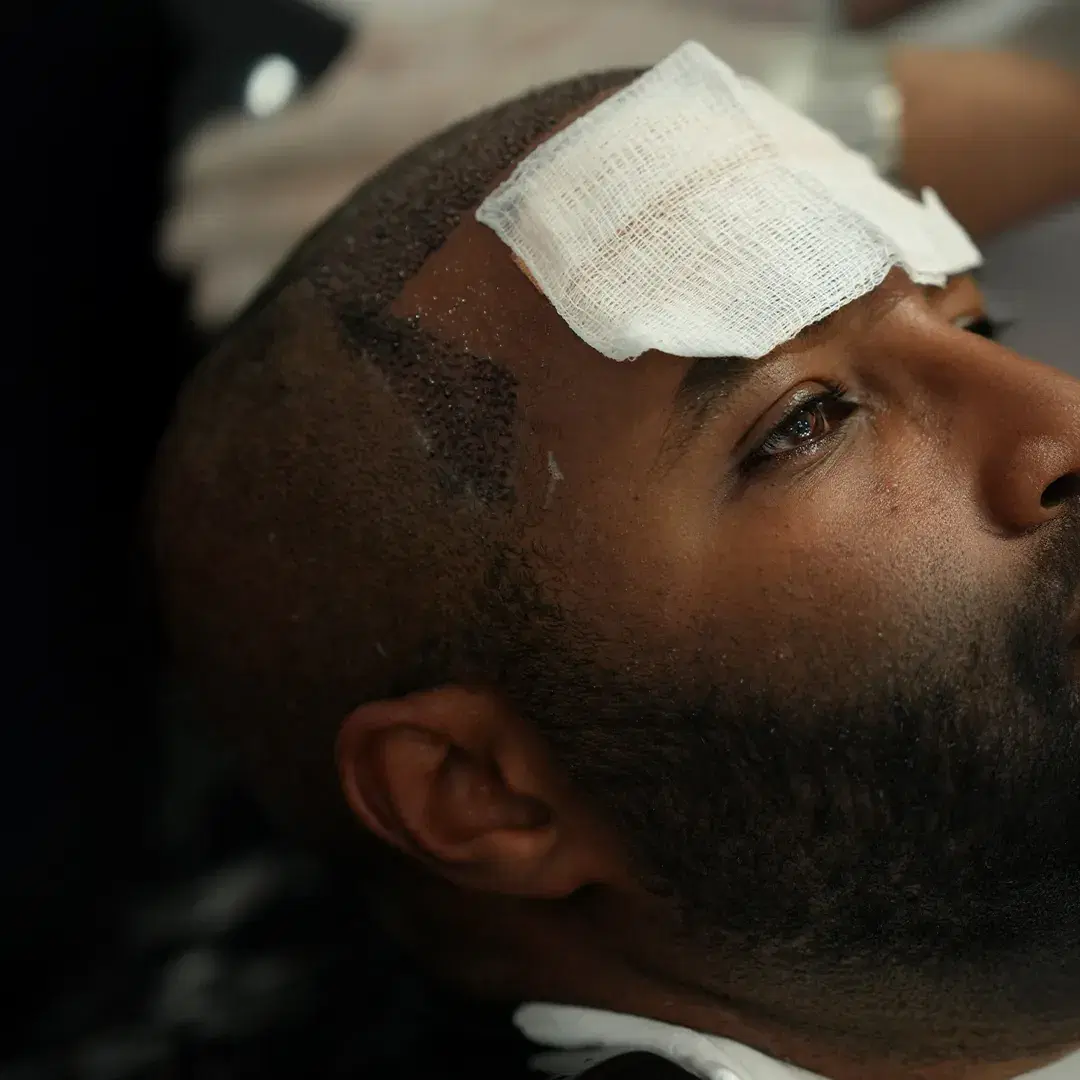 <h3><span style="color: rgb(247, 248, 248);">Immediately After the Transplant</span></h3>